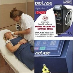 diolase-com-arzu-estetik-jet-lazer-laser-hair-removal-lazer-epilasyon-jet-laser-lazer-cihazi-device-diyot-diode-diod-diot-lazer-epilasyon-cihazlari-makineleri-01 diolase-com-arzu-estetik-jet-lazer-laser-hair-removal-lazer-epilasyon-jet-laser-lazer-cihazi-device-diyot-diode-diod-diot-lazer-epilasyon-cihazlari-makineleri-01